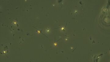 Chrysochromulina 500xlugol GoF SirpaLehtinen