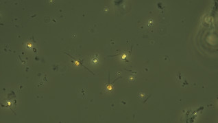 Chrysochromulina 500xlugol GoF SirpaLehtinen