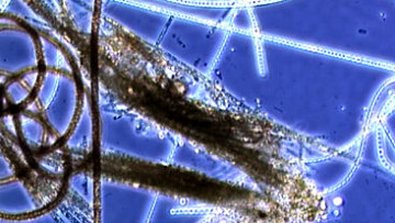 Bild på plankton på cellnivå. 